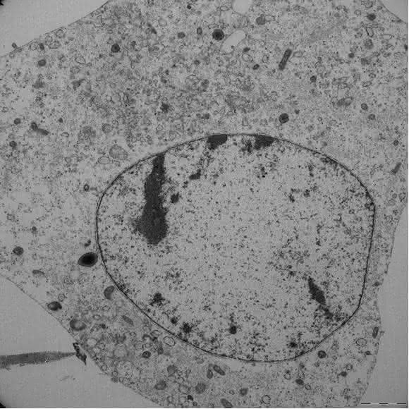 ferroptotische Zelle