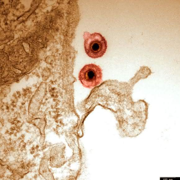 Herpesviruspatikel