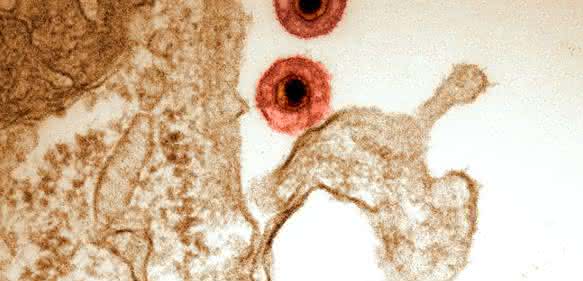 Herpesviruspatikel