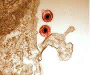 Herpesviruspatikel