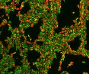 Krankheitserreger Pseudomonas aeruginosa