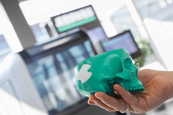 Implantat für Schädelknochen Implantat für Schädelknochen