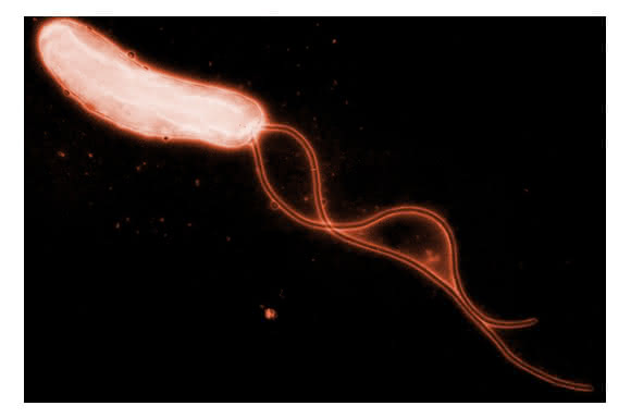 Helicobacter pylori. (Bild: R. Haas, Max von Pettenkofer-Institut)