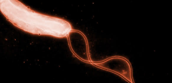 Helicobacter pylori. (Bild: R. Haas, Max von Pettenkofer-Institut)