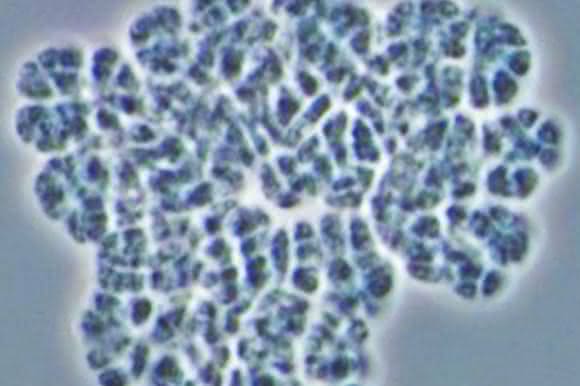 Die methanproduzierende Archaeen-Art Methanosarcina mazei ist ein in der Mikrobiologie häufig verwendeter Modellorganismus. (Abbildung: Andrea Ulbricht)