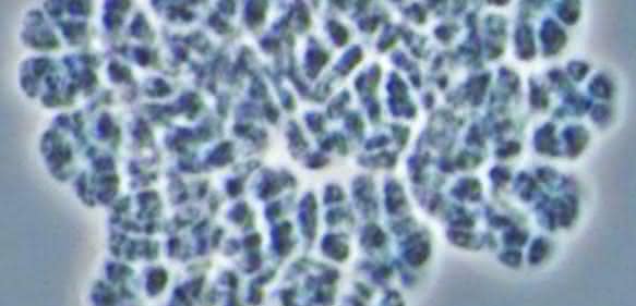 Die methanproduzierende Archaeen-Art Methanosarcina mazei ist ein in der Mikrobiologie häufig verwendeter Modellorganismus. (Abbildung: Andrea Ulbricht)