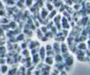 Die methanproduzierende Archaeen-Art Methanosarcina mazei ist ein in der Mikrobiologie häufig verwendeter Modellorganismus. (Abbildung: Andrea Ulbricht)