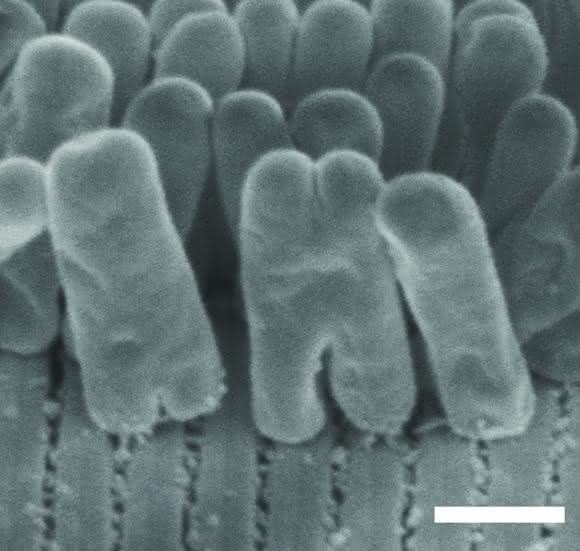 Elektronenmikroskopiebild des Robbea hypermnestra-Symbionten angeheftet an die Oberfläche seines Fadenwurm-Wirts. Der am Wirt angeheftete Pol ist eingeschnürter als der freiliegende. Maßstab: 1 µm. (Copyright: Nikolaus Leisch, Nature Microbiology)