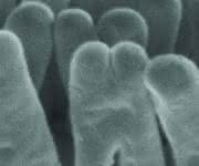 Elektronenmikroskopiebild des Robbea hypermnestra-Symbionten angeheftet an die Oberfläche seines Fadenwurm-Wirts. Der am Wirt angeheftete Pol ist eingeschnürter als der freiliegende. Maßstab: 1 µm. (Copyright: Nikolaus Leisch, Nature Microbiology)