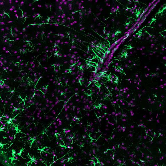 Mikroskopieaufnahme vom Hypothalamus der Maus. Die Tanyzyten und Astrozyten sind grün, die Zellkerne magenta eingefärbt. Die Tanyzyten und Astrozyten sind an der Verarbeitung von Lipidsignalen in diesem Teil des Gehirns beteiligt. (© Hofmann, AG Lars Kürschner, Universität Bonn)