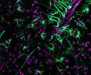 Mikroskopieaufnahme vom Hypothalamus der Maus. Die Tanyzyten und Astrozyten sind grün, die Zellkerne magenta eingefärbt. Die Tanyzyten und Astrozyten sind an der Verarbeitung von Lipidsignalen in diesem Teil des Gehirns beteiligt. (© Hofmann, AG Lars Kürschner, Universität Bonn)