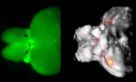 Das Bild zeigt  die stark lichtstreuende Struktur des Zebrafischgehirns. Das Fluoreszenzbild links macht deutlich, dass optische Mikroskopie hier an ihre Grenzen stößt und die Lichtbrechung keine einzelnen Signale zulässt. Das optoakustisch erzeugte Bild rechts ermöglicht hochaufgelöste und dreidimensionale Informationen zur Nervenaktivität (hier in Orange) in Echtzeit. (Quelle: Helmholtz Zentrum München)
