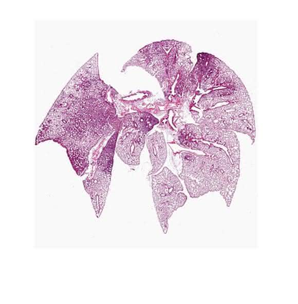 Lungenschnitt nach Ko-Infektion durch Influenza A-Viren und Pneumo-kokken. Die Färbung zeigt die ausgeprägte Entzündungsreaktion: Die entzündeten Areale der Lunge mit vielen eingewanderten Immunzellen sind als dunkle Verfärbungen zu erkennen. © HZI