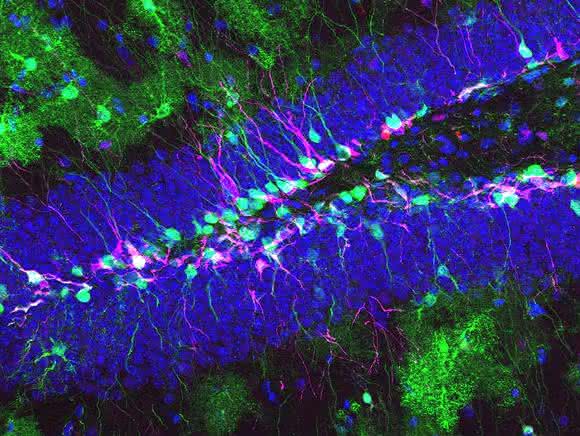 Neuronale Stammzellen im ausgewachsenen Hippocampus einer Maus. Grün: Die Stammzellen und ihre Nachkommen exprimieren Protein. Magenta: Die Stammzellen des Hippocampus produzieren neue Neuronen. Blau: Ausgereifte Granularzellen. (Bild: Universität Basel, Departement Biomedizin)