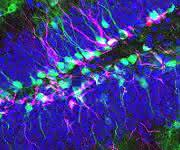 Neuronale Stammzellen im ausgewachsenen Hippocampus einer Maus. Grün: Die Stammzellen und ihre Nachkommen exprimieren Protein. Magenta: Die Stammzellen des Hippocampus produzieren neue Neuronen. Blau: Ausgereifte Granularzellen. (Bild: Universität Basel, Departement Biomedizin)