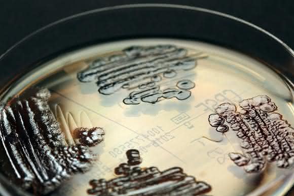 Multiresistente Enterobakterien in einer Petrischale nachgewiesen © IMMIH, Köln/Hamprecht