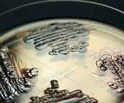 Multiresistente Enterobakterien in einer Petrischale nachgewiesen © IMMIH, Köln/Hamprecht