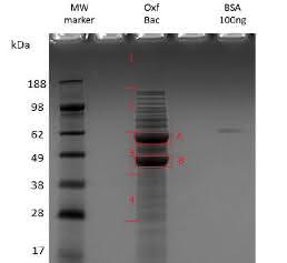 Proteome Dynamics of the Specialist: Oxalate Degrader Oxalobacter formigenes Proteome Dynamics of the Specialist: Oxalate Degrader Oxalobacter formigenes