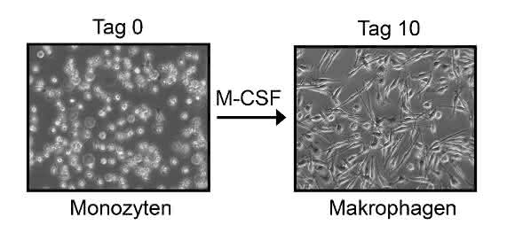 Mikroskopische Aufnahme von Monozyten (l.), aus denen das Forschungsteam über zehn Tage durch Zugabe des Zytokins M-CSF (Monozytenkolonien-stimulierender Faktor) Makrophagen differenziert haben.  Foto/Copyright: Dr. Christoph Garbers