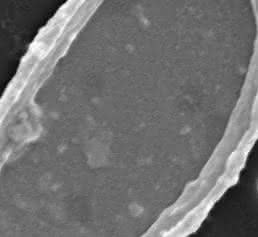 Eine Kalkschuppe, Coccolith genannt, besteht aus einer Bodenplatte, die vor allem aus Cellulose besteht und wie ein Tortenboden von einem Rand eingefasst wird. Am Rand sind abwechseln Kalk-Kristalle mit zwei unterschiedlichen Formen angeordnet. (© André Scheffel u. Damien Faivre / MPI für molekulare Pflanzenphysiologie) Eine Kalkschuppe, Coccolith genannt, besteht aus einer Bodenplatte, die vor allem aus Cellulose besteht und wie ein Tortenboden von einem Rand eingefasst wird. Am Rand sind abwechseln Kalk-Kristalle mit zwei unterschiedlichen Formen angeordnet. (© André Scheffel u. Damien Faivre / MPI für molekulare Pflanzenphysiologie)