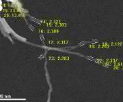 Alzheimer-Fibrillen