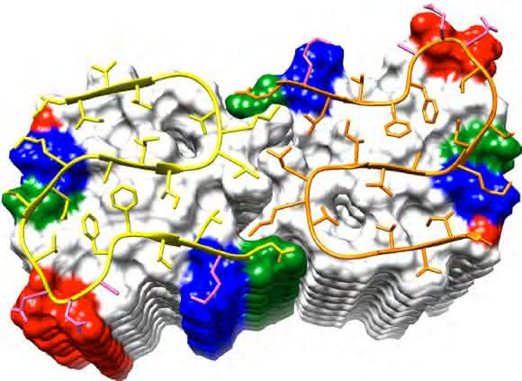 Amyloid-Beta-Fibrille