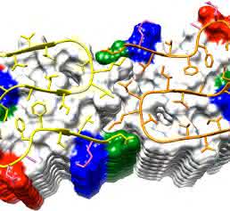 Amyloid-Beta-Fibrille