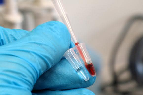 Farbreaktion beim Gennachweis mittels Meerrettich-Peroxidase. Farbreaktion beim Gennachweis mittels Meerrettich-Peroxidase.