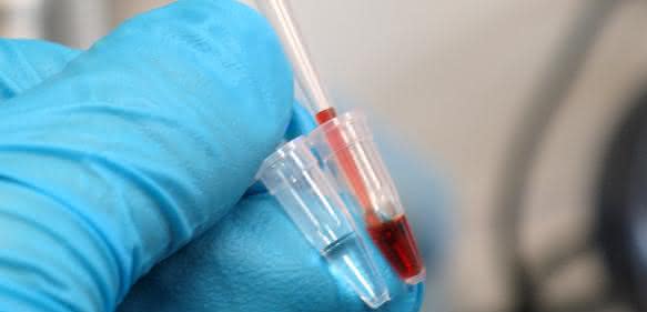 Farbreaktion beim Gennachweis mittels Meerrettich-Peroxidase.
