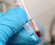 Farbreaktion beim Gennachweis mittels Meerrettich-Peroxidase.