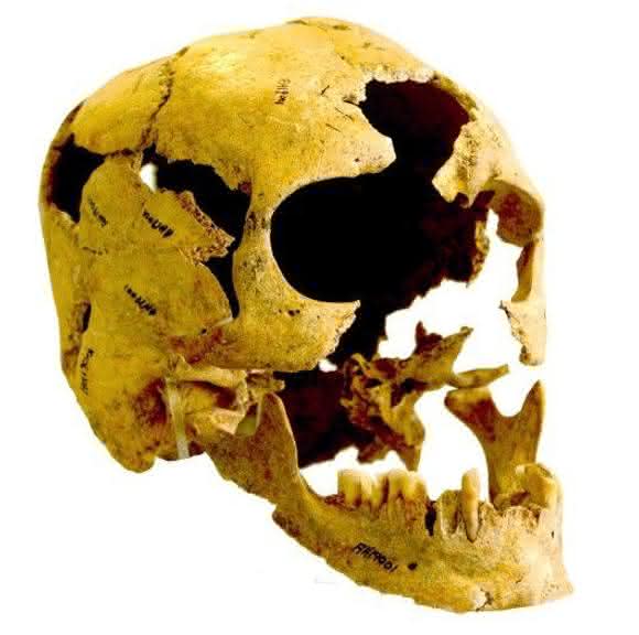 Schädel