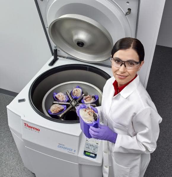 Thermo Scientific Blutbankzentrifugen Thermo Scientific Heraeus Cryofuge 8 bietet Platz für 6 x 550-ml-Blutbeutel und kann bei Verwendung des gleichen Bechersystems für 8 x 550-ml-Beutel aufgerüstet werden.