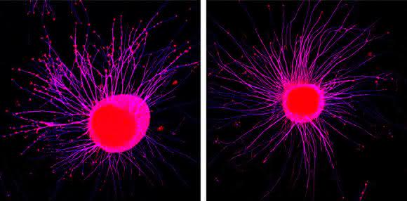 Membranständige Signalmoleküle können Nervenzellfortsätze auch über die Distanz hinweg zum Rückzug bewegen. So kollabieren die Wachstumskegel junger Nervenzellfortsätze (links im Bild, rote Verdickungen) nach dem Kontakt mit Eph-Rezeptoren aus Exosomen (rechtes Bild). (© MPI für Neurobiologie / Gong)