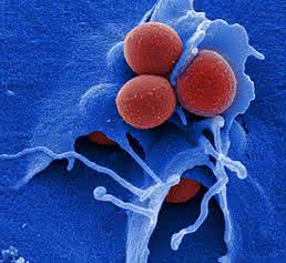 Das Bakterium Staphylococcus aureus (rot) bildet häufig Resistenzen gegen Antibiotika aus. Methicillinresistente Staphylococcus aureus-Stämme (MRSA) sind besonders für Patienten gefährlich, die bereits unter einer Infektion mit dem AIDS-Erreger HIV leiden. (© HZI / M. Rohde) Das Bakterium Staphylococcus aureus (rot) bildet häufig Resistenzen gegen Antibiotika aus. Methicillinresistente Staphylococcus aureus-Stämme (MRSA) sind besonders für Patienten gefährlich, die bereits unter einer Infektion mit dem AIDS-Erreger HIV leiden. (© HZI / M. Rohde)
