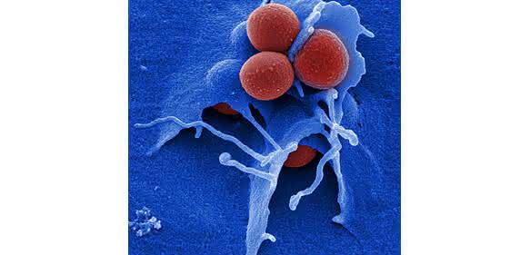 Das Bakterium Staphylococcus aureus (rot) bildet häufig Resistenzen gegen Antibiotika aus. Methicillinresistente Staphylococcus aureus-Stämme (MRSA) sind besonders für Patienten gefährlich, die bereits unter einer Infektion mit dem AIDS-Erreger HIV leiden. (© HZI / M. Rohde)