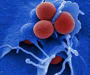 Das Bakterium Staphylococcus aureus (rot) bildet häufig Resistenzen gegen Antibiotika aus. Methicillinresistente Staphylococcus aureus-Stämme (MRSA) sind besonders für Patienten gefährlich, die bereits unter einer Infektion mit dem AIDS-Erreger HIV leiden. (© HZI / M. Rohde)
