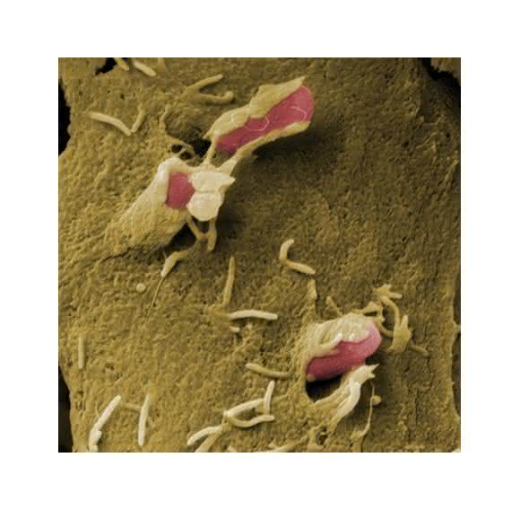 Die genetische Ausstattung ihres Virulenzplasmids ermöglicht es Bakterien der Gattung Yersinia, die Immunabwehr des befallenen Organismus auszuschalten Die genetische Ausstattung ihres Virulenzplasmids ermöglicht es Bakterien der Gattung Yersinia, die Immunabwehr des befallenen Organismus auszuschalten