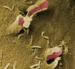 Die genetische Ausstattung ihres Virulenzplasmids ermöglicht es Bakterien der Gattung Yersinia, die Immunabwehr des befallenen Organismus auszuschalten Die genetische Ausstattung ihres Virulenzplasmids ermöglicht es Bakterien der Gattung Yersinia, die Immunabwehr des befallenen Organismus auszuschalten