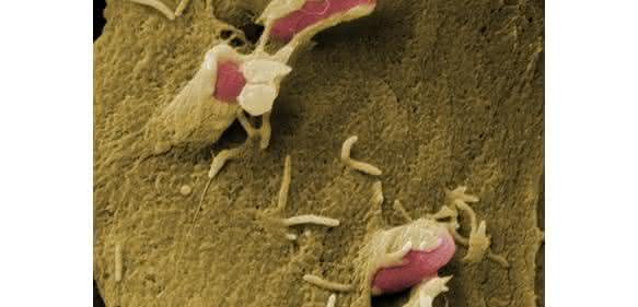 Die genetische Ausstattung ihres Virulenzplasmids ermöglicht es Bakterien der Gattung Yersinia, die Immunabwehr des befallenen Organismus auszuschalten
