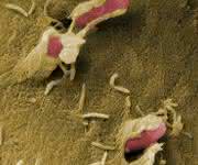Die genetische Ausstattung ihres Virulenzplasmids ermöglicht es Bakterien der Gattung Yersinia, die Immunabwehr des befallenen Organismus auszuschalten