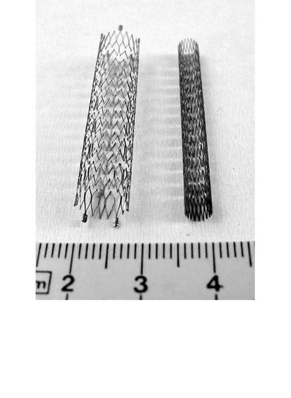 Formgedächtnislegierung Nitinol Formgedächtnislegierung Nitinol in Gefäßstütze