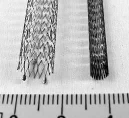 Formgedächtnislegierung Nitinol in Gefäßstütze