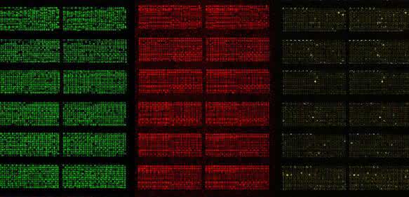 Protein-Microarrays ermöglichen es, tausende Proteine in einem einzigen Experiment zu studieren. Microarrays sind wenige Zentimeter groß und haben tausende Testfelder auf kleinstem Raum (Foto: TUM/Falter-Braun)