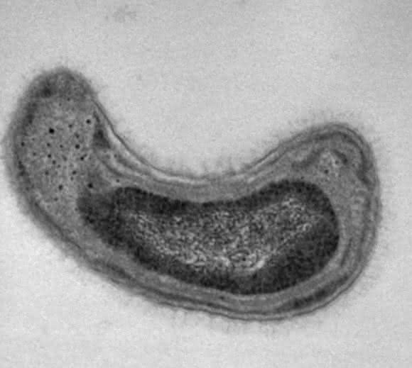 Methylosinus trichosporium. (Quelle: Jeremy Semrau, University of Michigan)