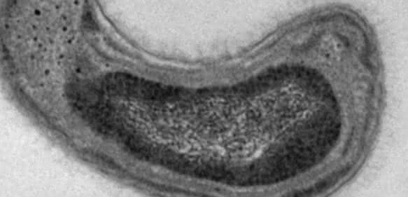 Methylosinus trichosporium. (Quelle: Jeremy Semrau, University of Michigan)