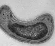 Methylosinus trichosporium. (Quelle: Jeremy Semrau, University of Michigan)