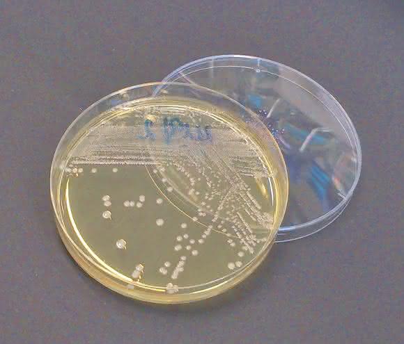 Multiresistente Bakterien in der Petrischale. (Foto: Justus-Liebig-Universität Gießen)