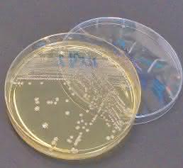 Multiresistente Bakterien in der Petrischale. (Foto: Justus-Liebig-Universität Gießen)