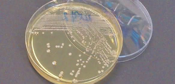 Multiresistente Bakterien in der Petrischale. (Foto: Justus-Liebig-Universität Gießen)