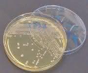 Multiresistente Bakterien in der Petrischale. (Foto: Justus-Liebig-Universität Gießen)